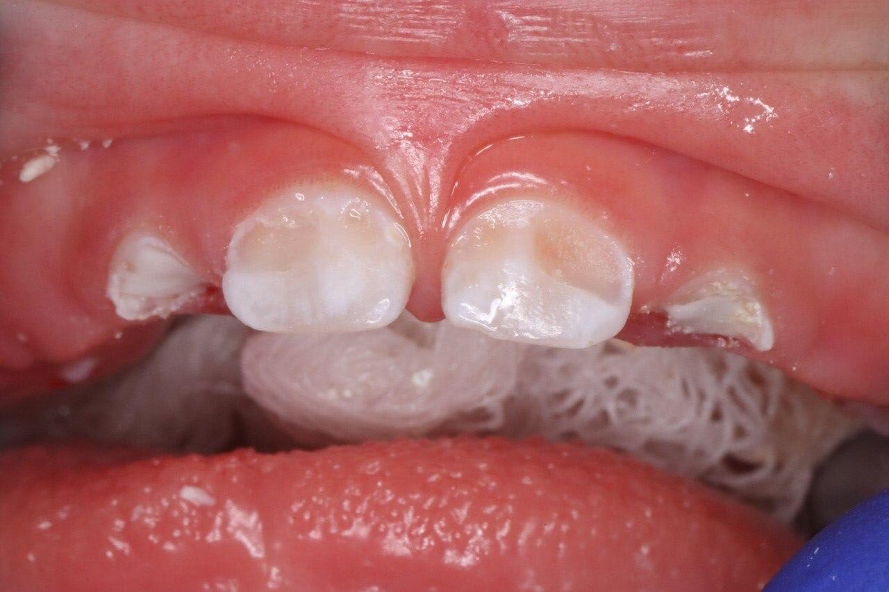 Before
