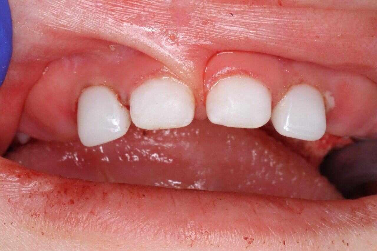 After